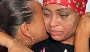 VÍDEO: Mulher dada como morta  por engano agradece equipe médica após alta do hospital em Bauru: 'Tô bem'